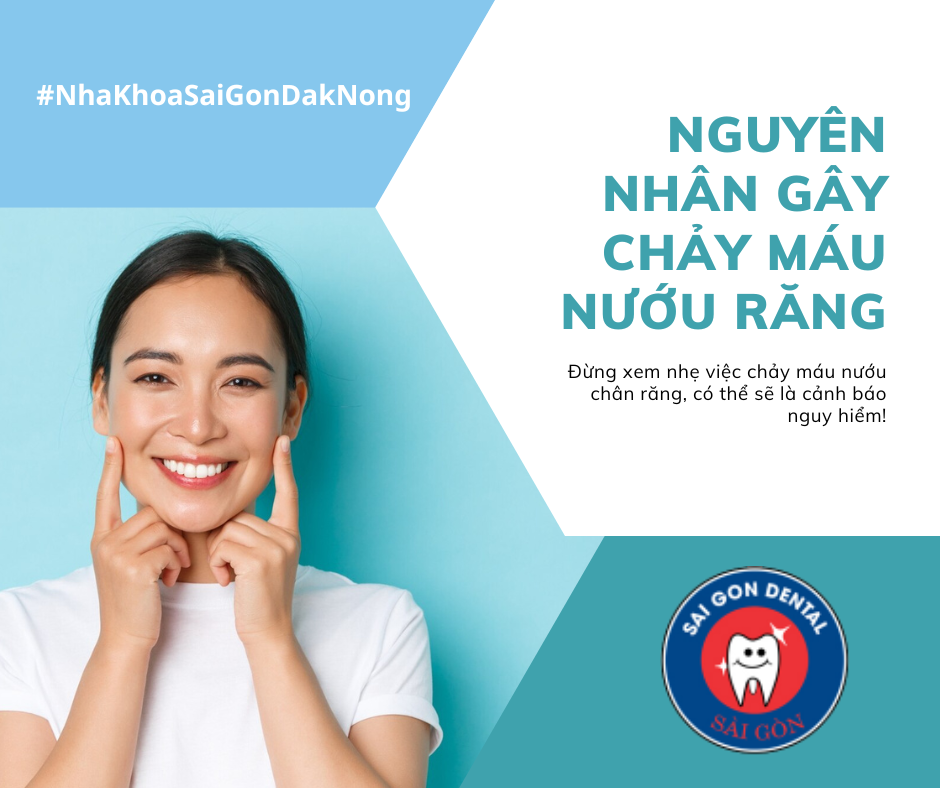 Nguyên nhân gây chảy máu nướu chân răng